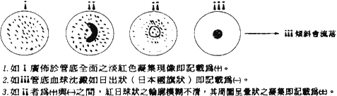 判定法